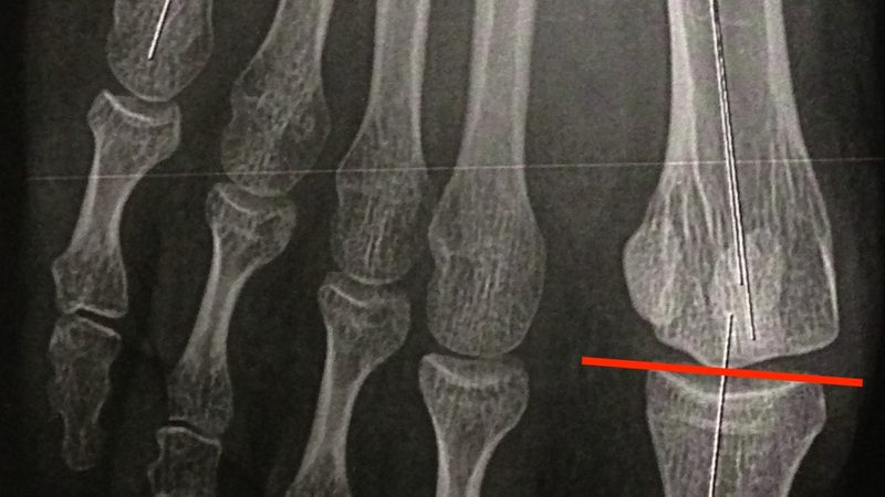 空调滤清器低价不等于低成本：滤芯背后的隐形账